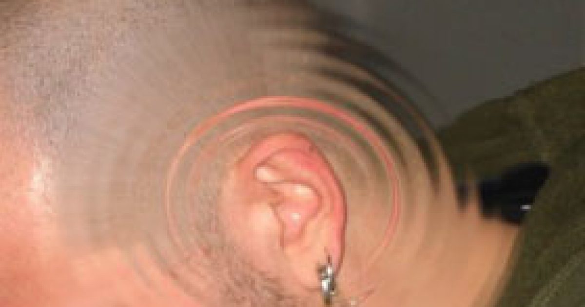 A fülzúgás oka az agyban keresendő