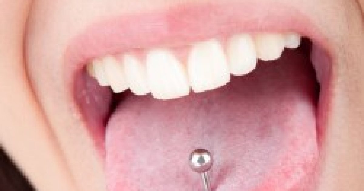 a nyelv piercingje miatt lefogyok in30 zsírégető jupiter