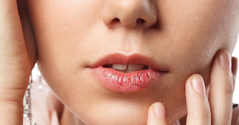 Mi segít a szájszárazság ellen?