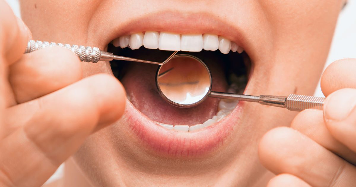 Hogyan ismerhető fel időben a fogínygyulladás?