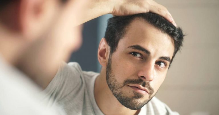 Hajhullás: nem mindegy, hogyan hullik a haja
