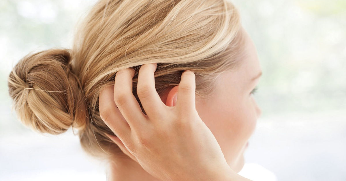Hogyan kezeljük a sebes fejbőrt? – Natúrsziget