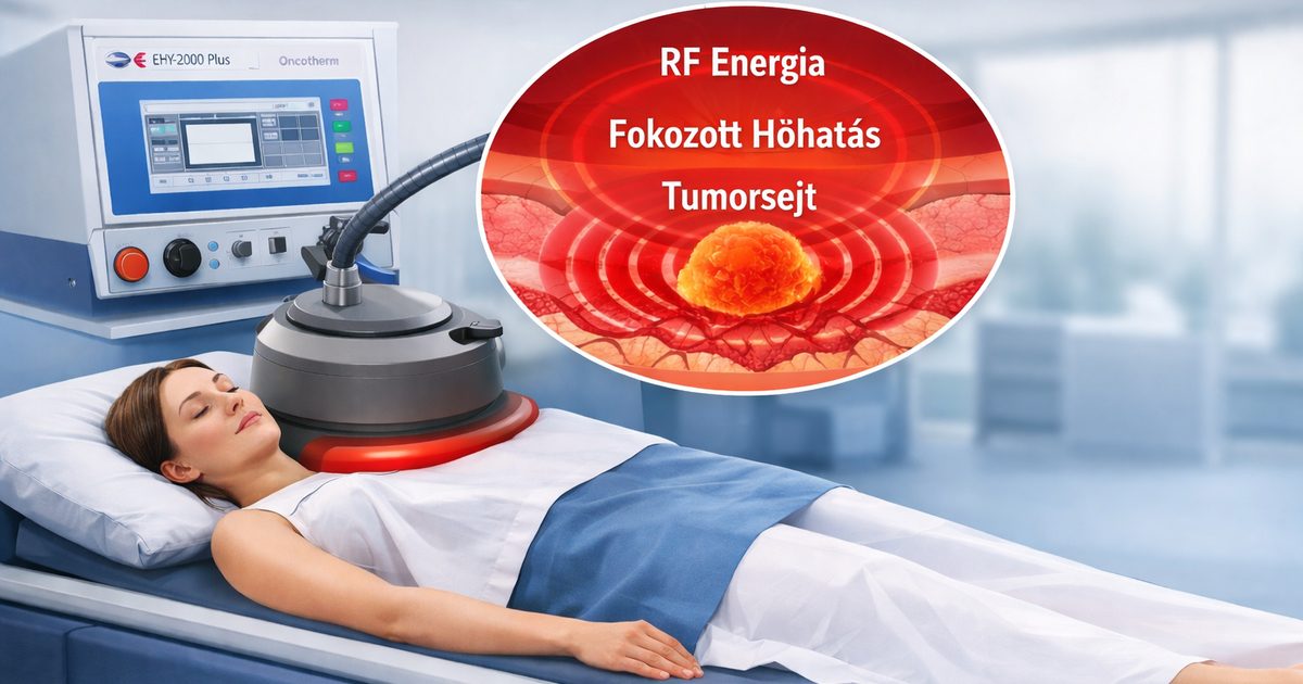 Daganatkezelés: nem orvosi módszerek (2.)